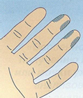 Подушечка пальца